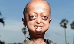 ১৪ বছরের আলি বন্দী ১১০ বছরের শরীরে